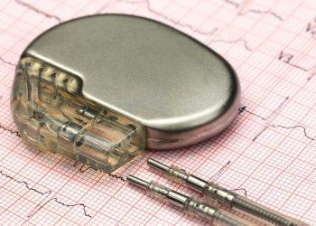 Close up of a pacemake on Electrocardiograph